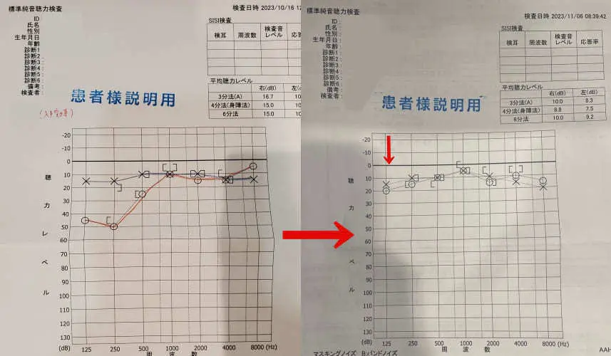 聴力検査
