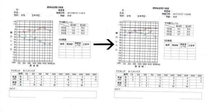 聴力検査